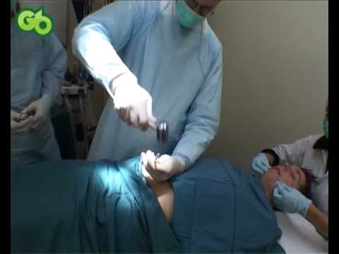 See video