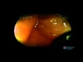 Steven H. Erdman, MD