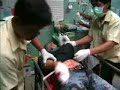 Serious Injury From Gunshot