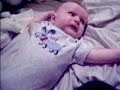 infantile spasms/seizures