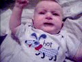 infantile spasms/seizures infantile spasms/seizures
