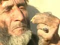 Man Eating Live Scorpion