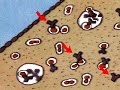 How the Body Works :  How Bacteria Cause Disease Connective Tissue Disorders