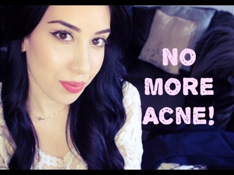 how to heal acne scars