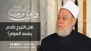 هل التبرع بالدم يفسد الصيام ؟ | أ.د. #علي_جمعة