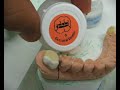 Como Aplicar Ceramica em Casos com Pouco Espaço Como Aplicar Ceramica em Casos com Pouco Espaço