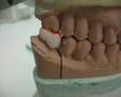 Como Aplicar Ceramica em Casos com Pouco Espaço