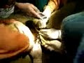 vicente-sotto-hospital-scandal-breaking-news.html