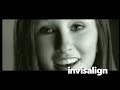 Invisalign Braces