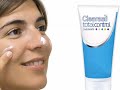 Treating Mild Acne (Acne #4)