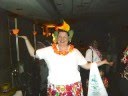 Gastric Bypass Patient Three Years After Surgery