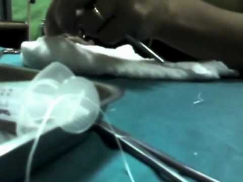 Punto continuo para episiotomía.wmv