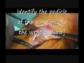 Recurrent Dorsal Ganglion Recurrent Dorsal Ganglion