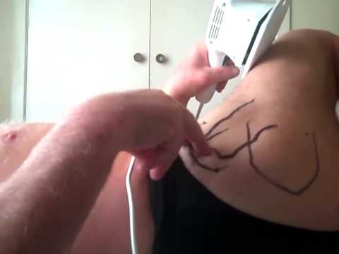 how to relieve osteoarthritis hip pain