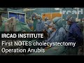 Operation Anubis - First NOTES cholecystectomy