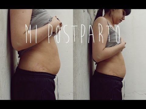 » Un mes postparto | Episiotomía, estreñimiento, lactancia, etc.