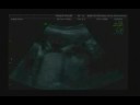 baby o yawn.mpeg