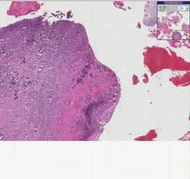 Histopathology Bone, ...
