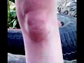 Faces in knees Faces in knees
