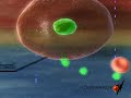 Cómo tratar la ciática con éxito mediante hipertermia