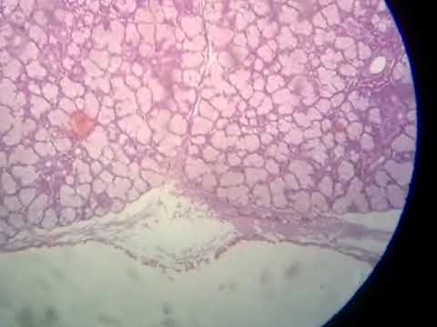 how to dissolve sputum