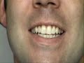 Thumbnail #1