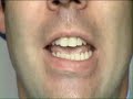 Thumbnail #2