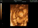 carson-williams-and-parker-3d-symphony-in-lights.html