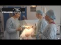 Gastric bypass operation performed by Guy Slater