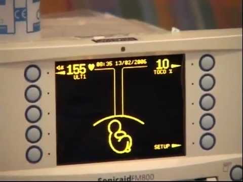 how to relieve afterpains