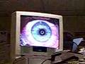 My Lasik Operation My Lasik Operation