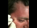 Huge zit pop