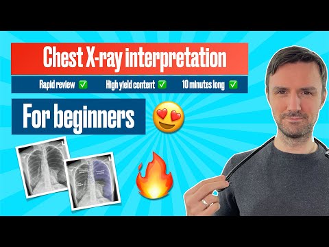 how to pass chest x-ray exam