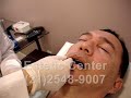 Bioplastia - Preechimento Facial - Estetic Center