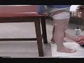 NUPT LID Bandaging VID 4