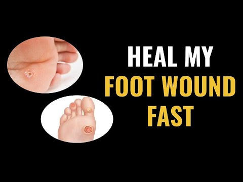 how to cure wounds fast