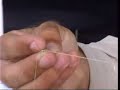 Gt knot