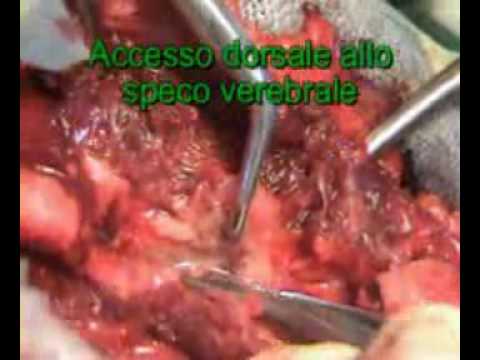 Immagine anteprima YouTube