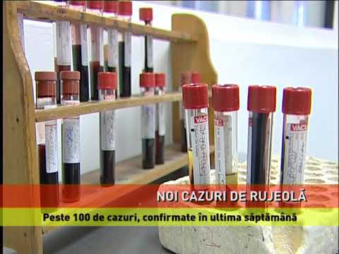 Noi cazuri de rujeolă, în Botoşani