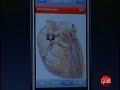 WWDC 2008 News: Human anatomy software for iPhone debuts