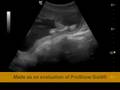 Our unborn child