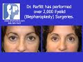 Eyelid Lift Blepharoplasty by Dr. Richard Parfitt Eyelid Lift Blepharoplasty by Dr. Richard Parfitt