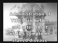 ALS - Amyotrophic Lateral Sclerosis - Lou Gehrigs Research