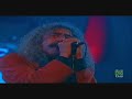 Los Suaves - El Jard�n de las Delicias (1) - Radio 3