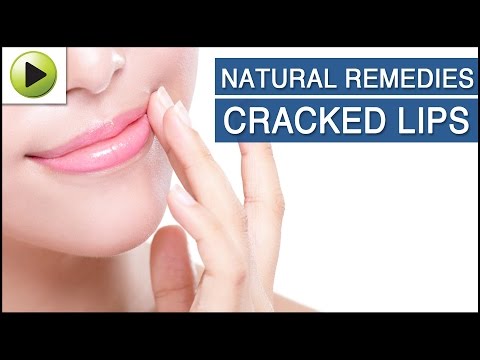 how to cure cracked lips
