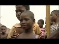 The Pulse - The big 3 v neglected diseases -29Oct07 -Ep1-Pt1
