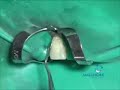 dental recostruction - stefano mascolo