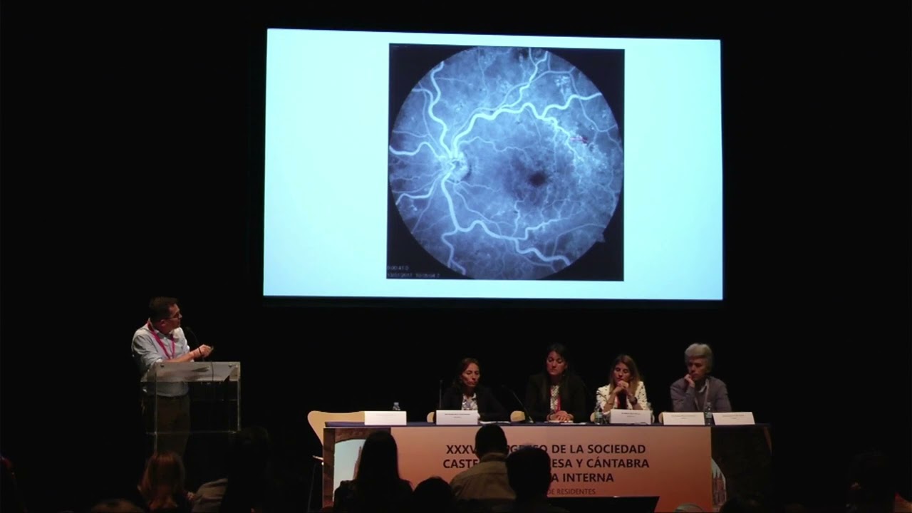 Como afrontar al paciente con uveitis en Medicina Interna Luis Corral Gudino
