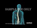 If you like this animation, LIKE us on Facebook: www.nucleusinc.com www.nucleusinc.com This 3D medical animation shows the anatomy of the spine.
