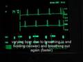 breath induced speeding up / slowing down of heart rhythm